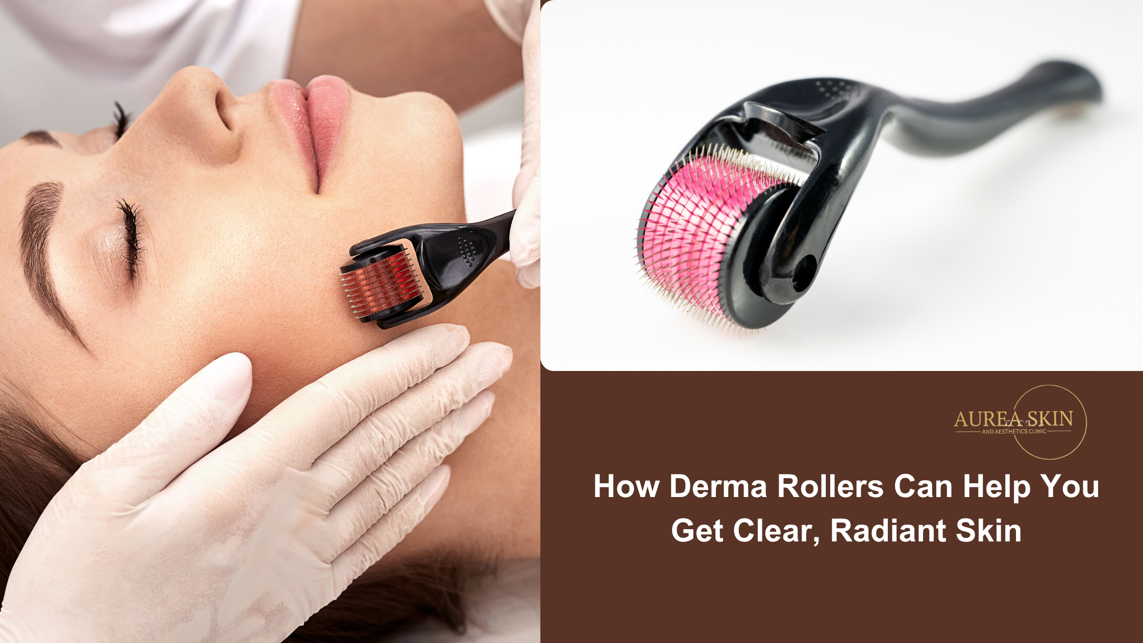 Microneedling for Acne Scars & Skin Rejuvenation: Benefits, Procedure, Recovery & Expert Advice